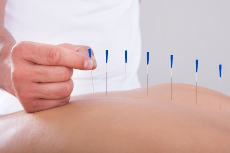 Vucut akupunkturu nelere iyi gelir