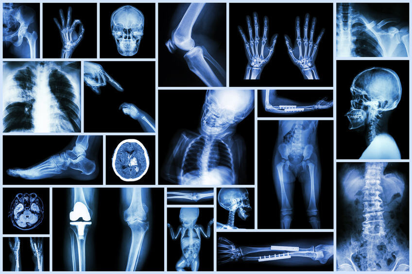 ortopedi ve travmatoloji